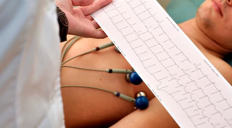 Electrocardiograma