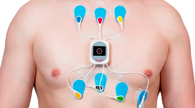Holter de 24/48 horas